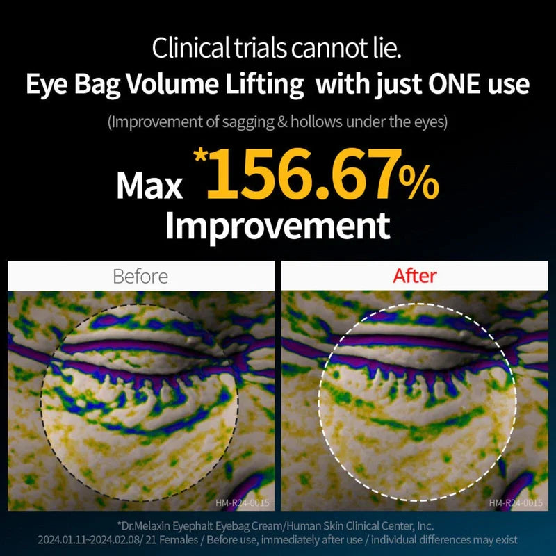 Dr.Melaxin Eyephalt Eyebag Cream